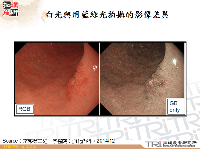 白光與用藍綠光拍攝的影像差異