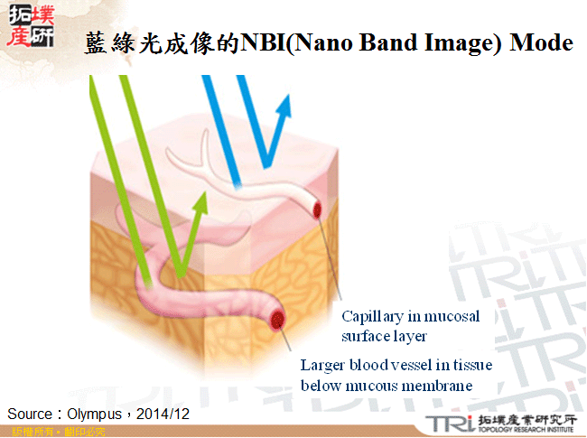 藍綠光成像的NBI(Nano Band Image) Mode